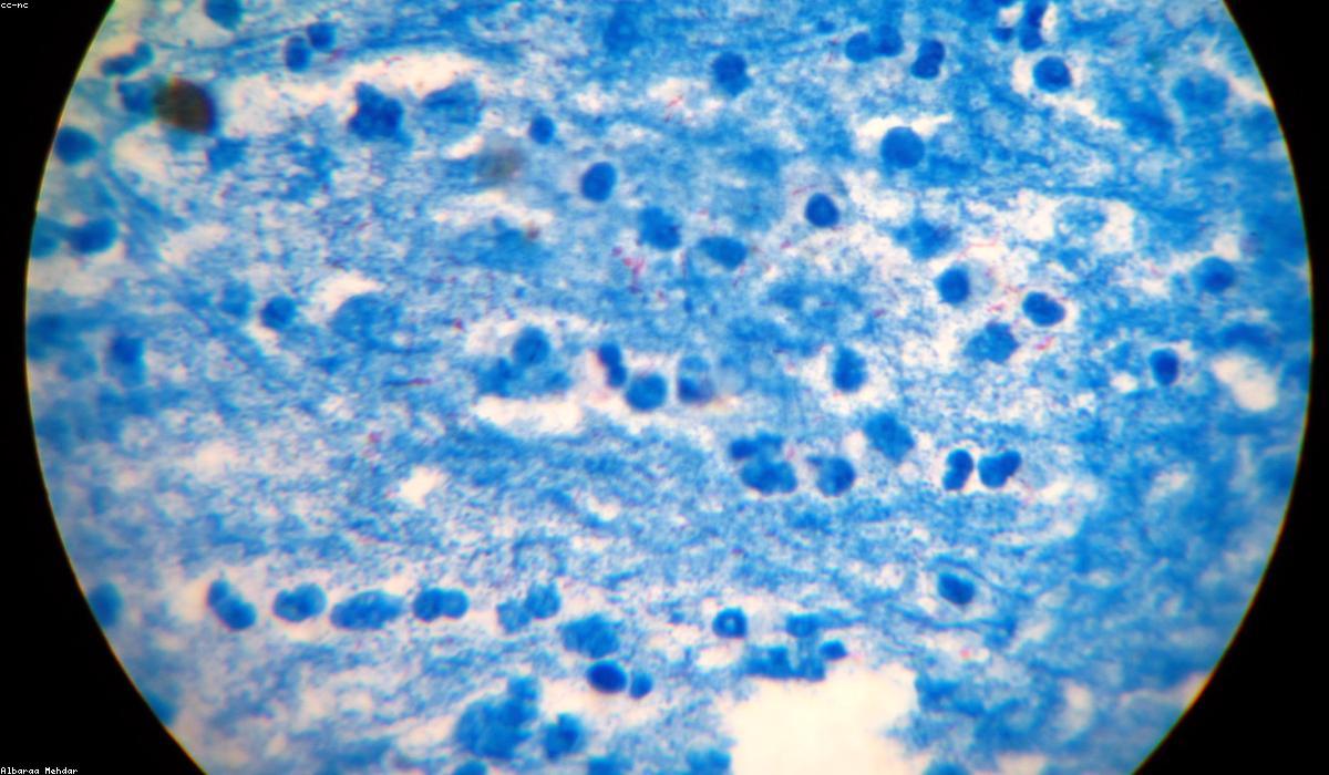 Bacteria under microscope