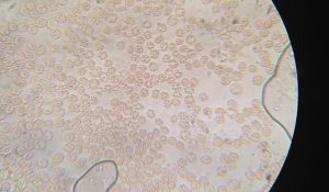 Red blood cells under a microscope