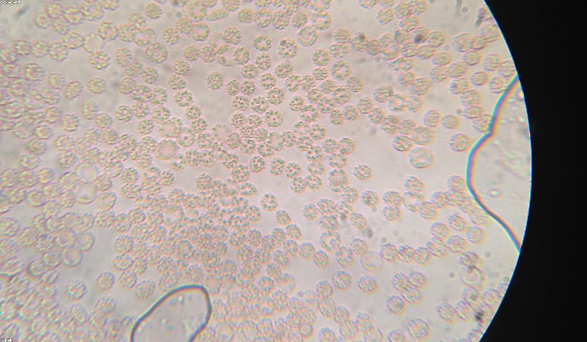 Red blood cells under a microscope
