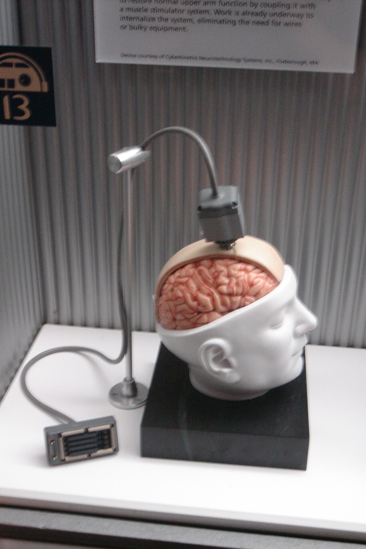 An implanted brain-computer interface device