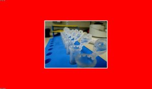 A cancer cell under research