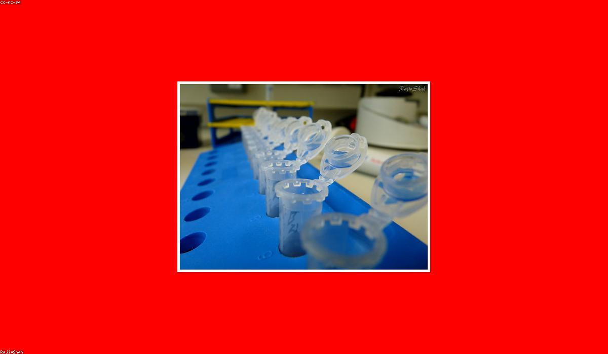 A cancer cell under research