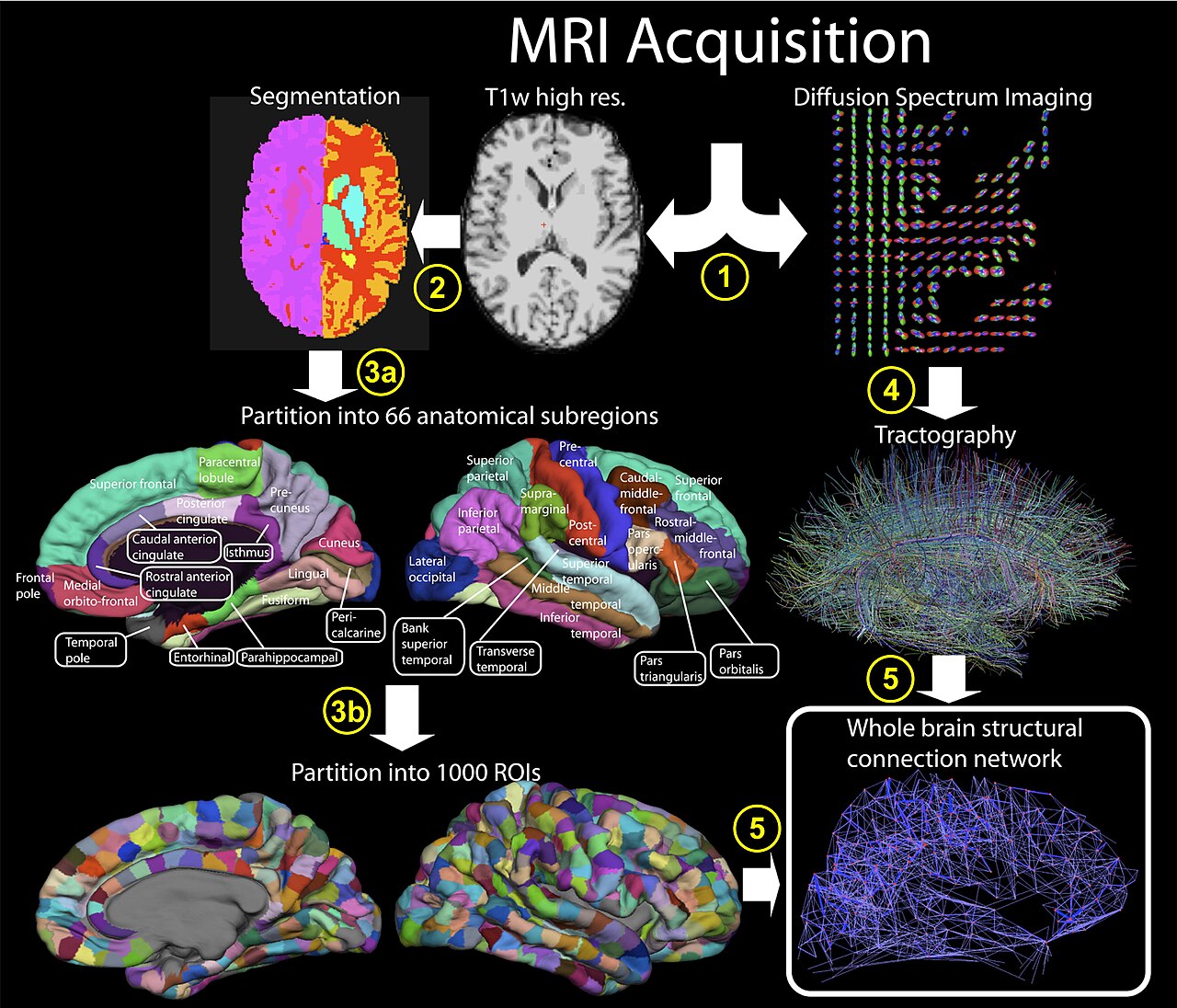 Procedure for extracting a brain connectome