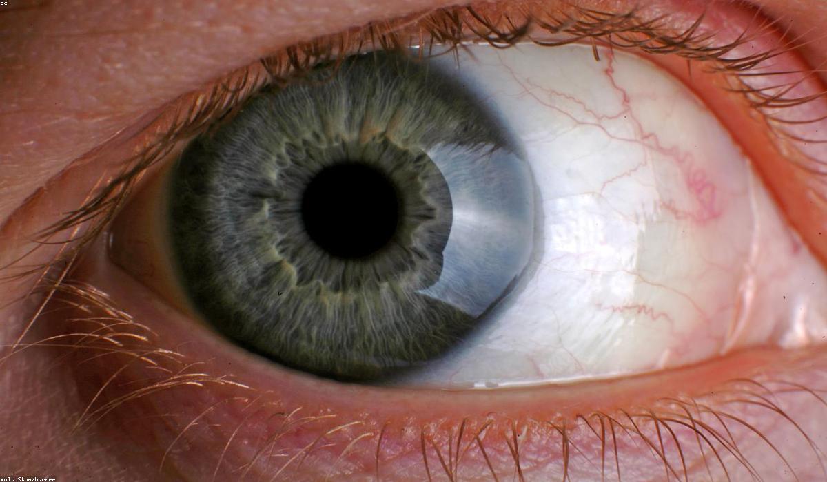 A close up of an eye