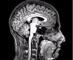An fMRI brain scan