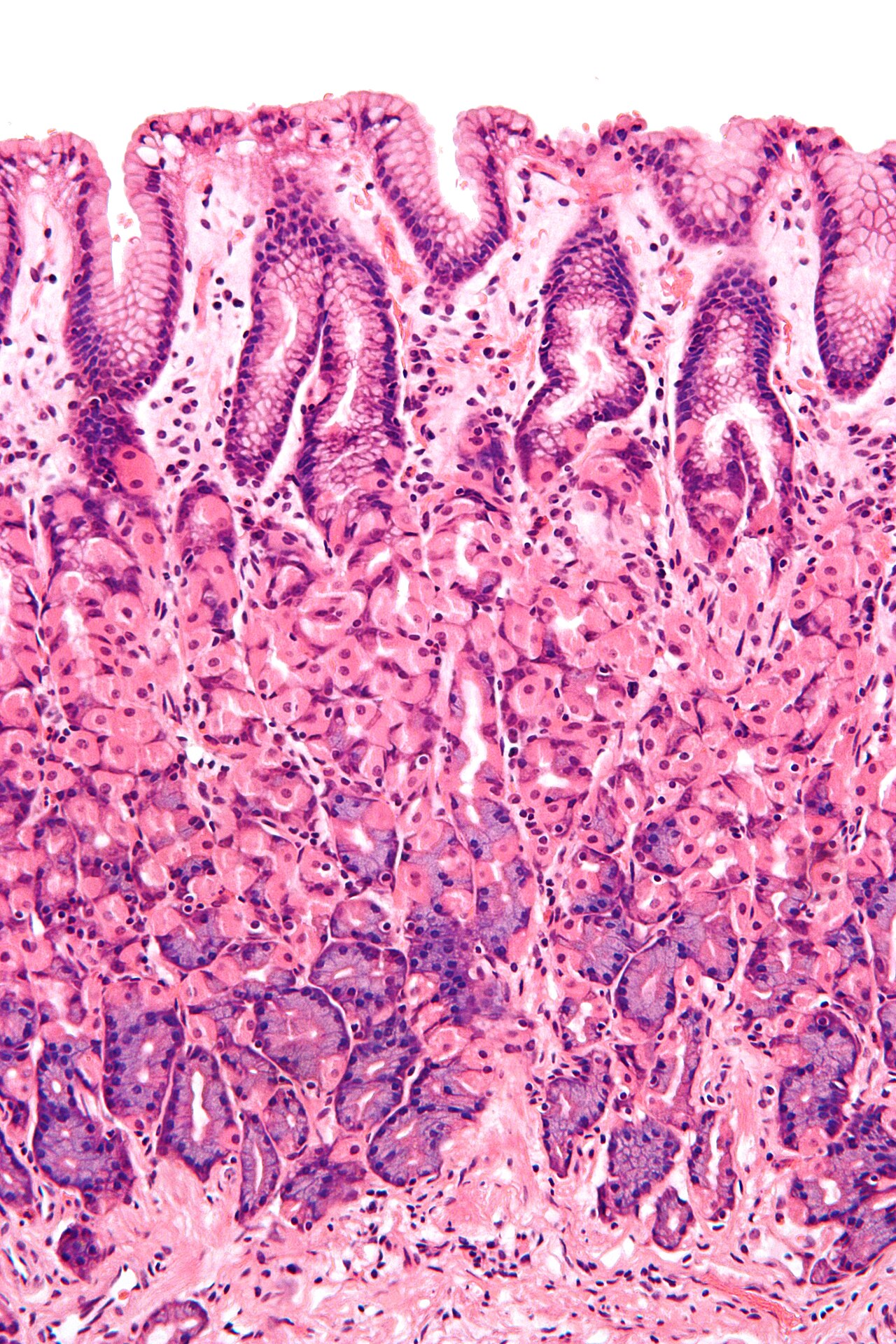 Microscope view of gastric mucosa
