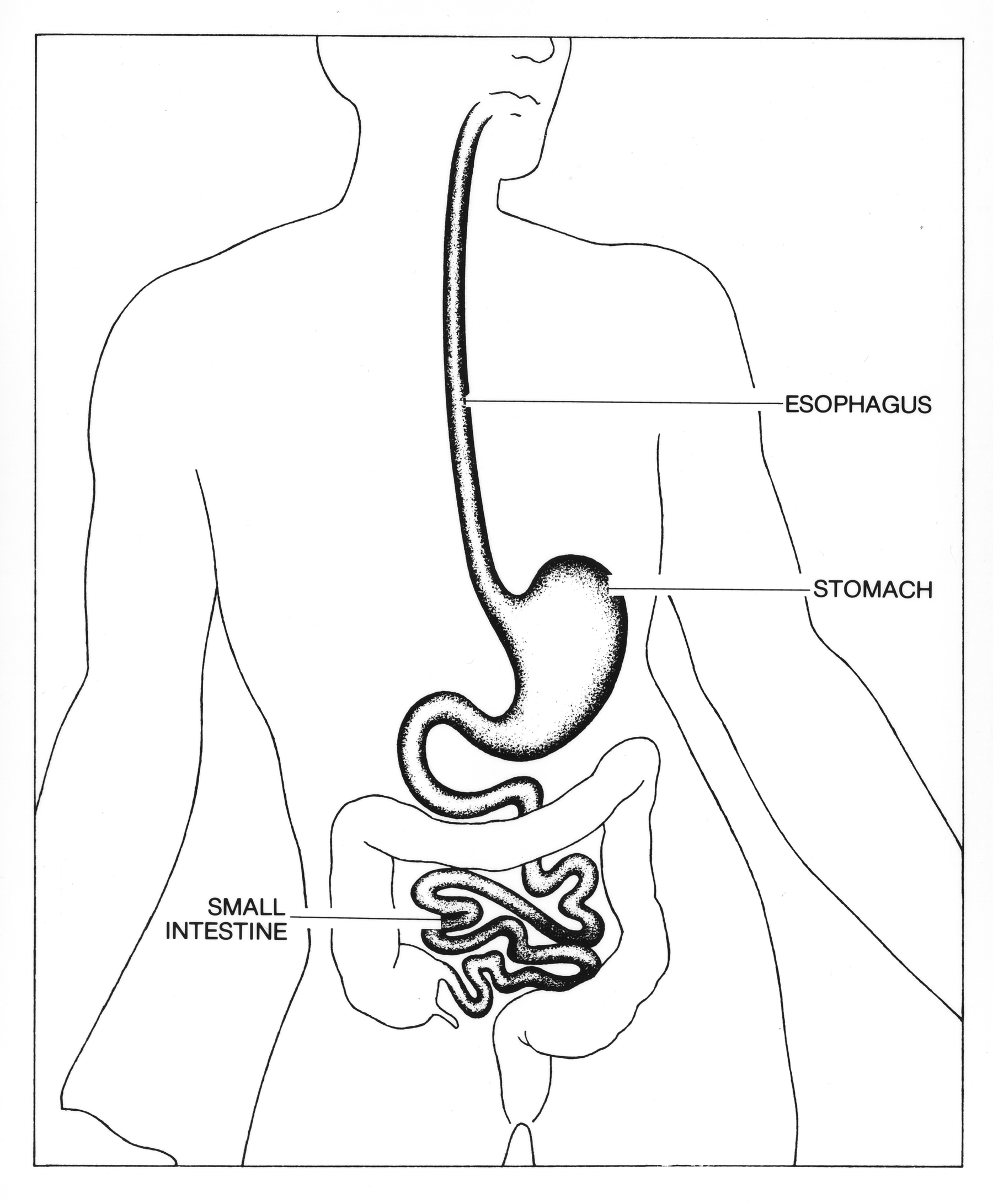 The esophagus leads into the stomach, where reflux begins — Wikimedia Commons (public domain)