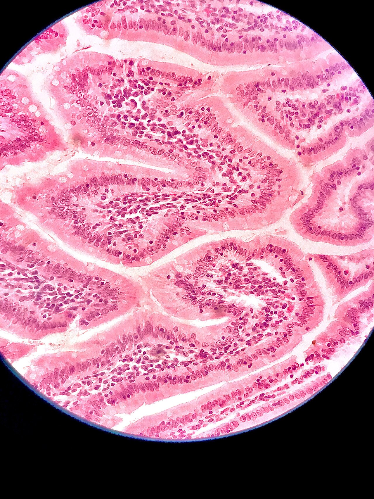 Close-up of intestinal villi