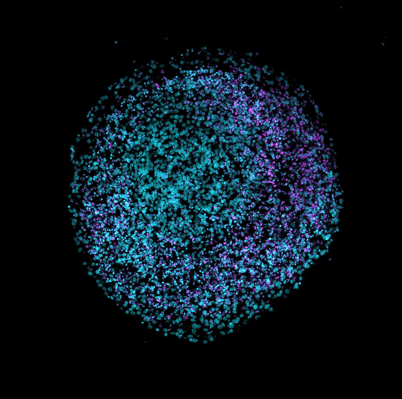 A human brain organoid