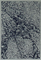 Helicobacter pylori, the bacterium behind most ulcers — Wikimedia Commons (public domain)