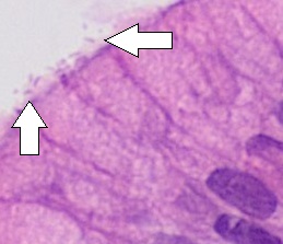 Microscopic view of H. pylori in the stomach lining — Wikimedia Commons (CC0)