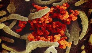 A virus under microscope